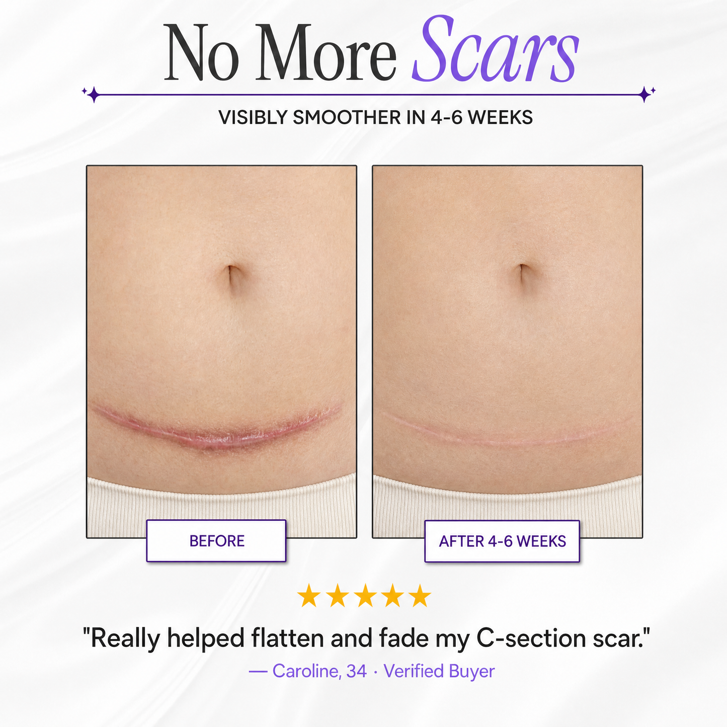 ScarFade Pro – Medical-Grade Silicone Scar Sheets for Surgical, Keloid & Burn Scars"