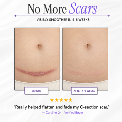 ScarFade Pro – Medical-Grade Silicone Scar Sheets for Surgical, Keloid & Burn Scars"